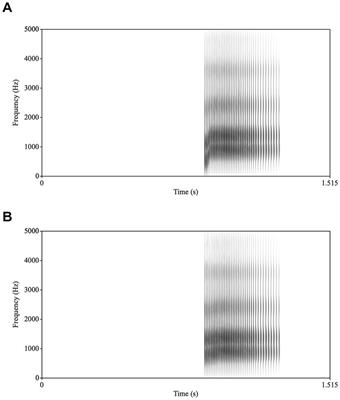 Where on the face do we look during phonemic restoration: An eye-tracking study